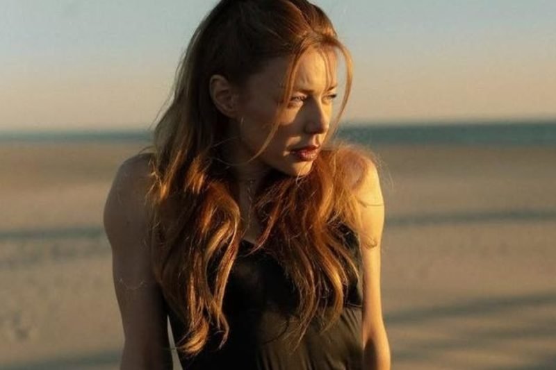 Тіна Кароль вперше розповіла про секрети своїх уколів краси.