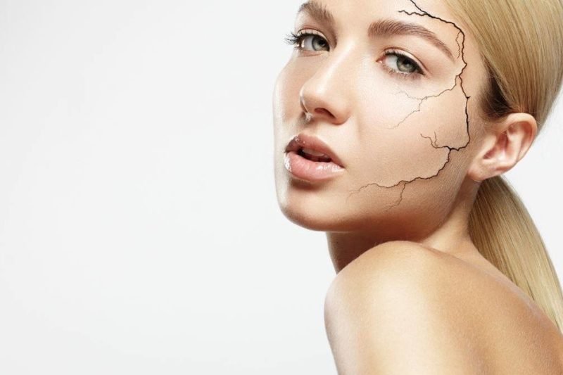 Підступна естетика: які косметичні процедури можуть зашкодити перед пластичною операцією — думка хірурга Березовського