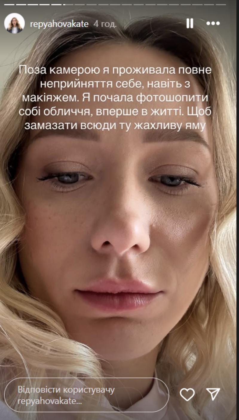 Репяхова поскаржилася на невдалу пластику