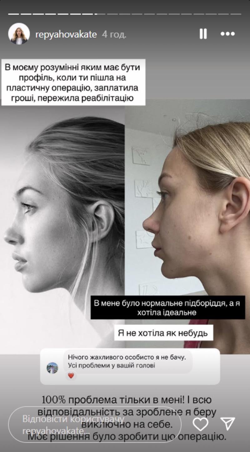 Репяхова поскаржилася на невдалу пластику