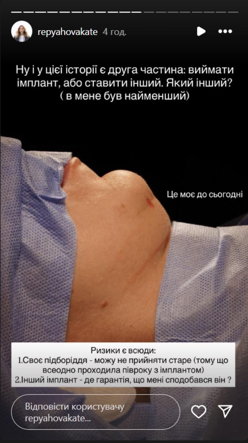 Репяхова поскаржилася на невдалу пластику