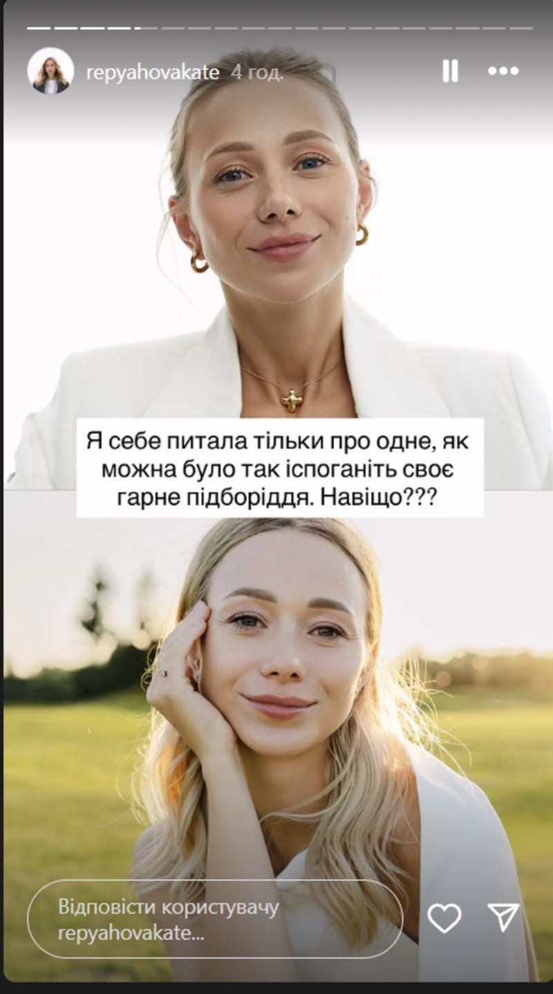 Репяхова поскаржилася на невдалу пластику